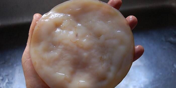 Kombucha contro i funghi delle unghie